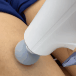 Masajeador Muscular Mini relajación